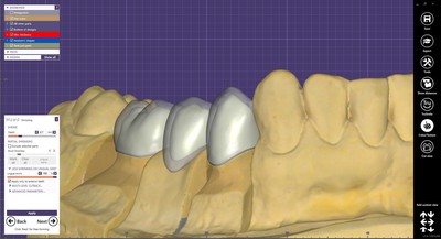 BANJA LUKA EXOCAD – Osnovni