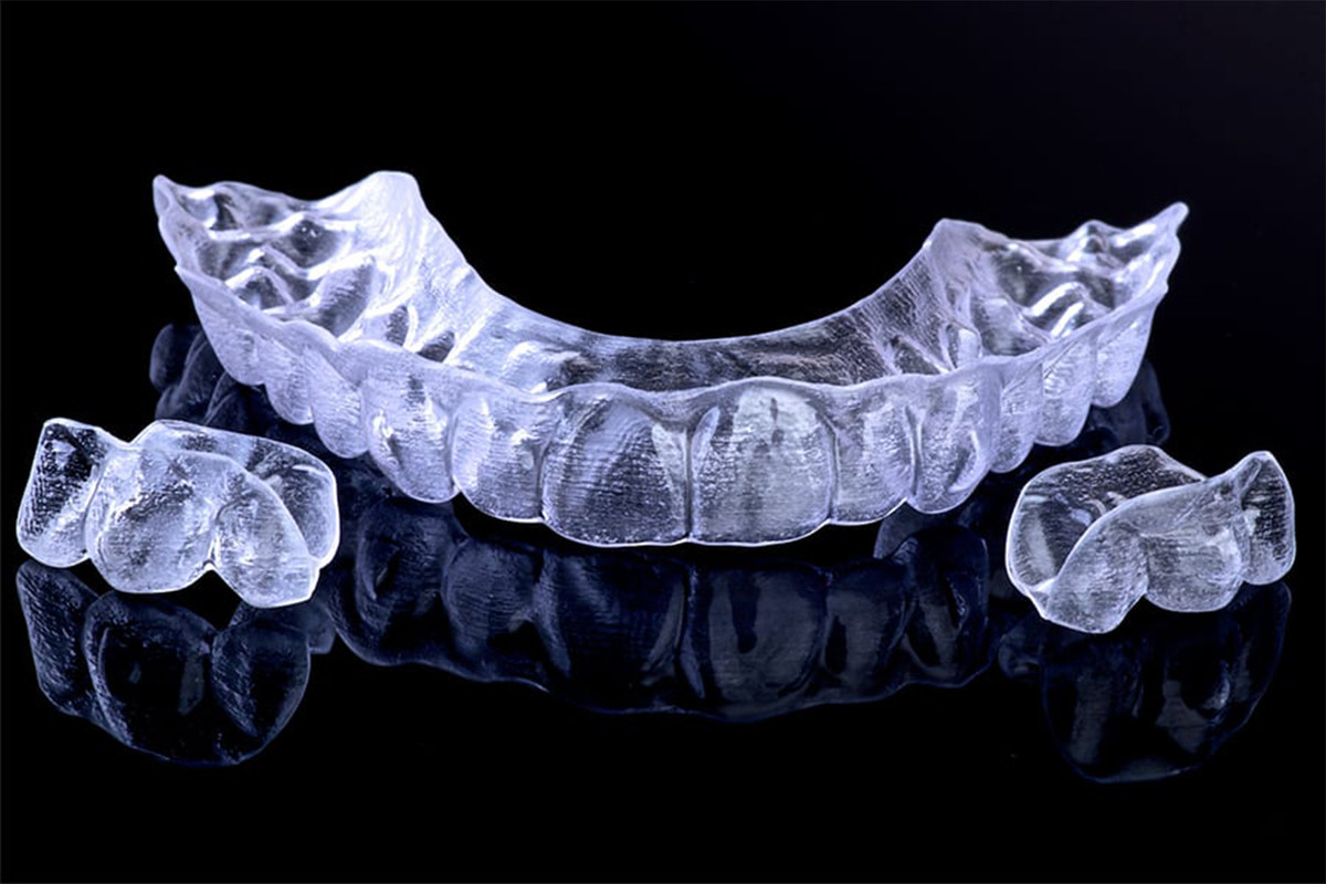 ortodontski-aparati_2/clear-aligner